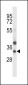 TRIM34 Antibody (N-term)